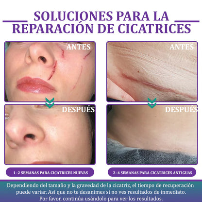 Flysmus® ReGen Cinta de Micronadles con Ácido Hialurónico Nano-Heal 💝